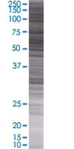 Abnova OXCT1 293T Cell Transient Overexpression Lysate (Denatured) 100 &mu;L | Buy Online | Abnova&trade; | Fisher Scientific