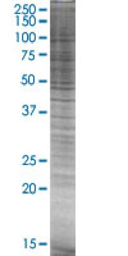 Abnova&trade;&nbsp;P2RX5 293T Cell Transient Overexpression Lysate (Denatured) (T02)