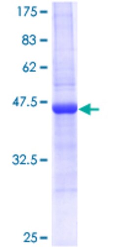 Abnova™ Human REG3A Full-length ORF (AAH36776, 1 a.a. - 175 a.a.) Recombinant Protein with GST-tag at N-terminal