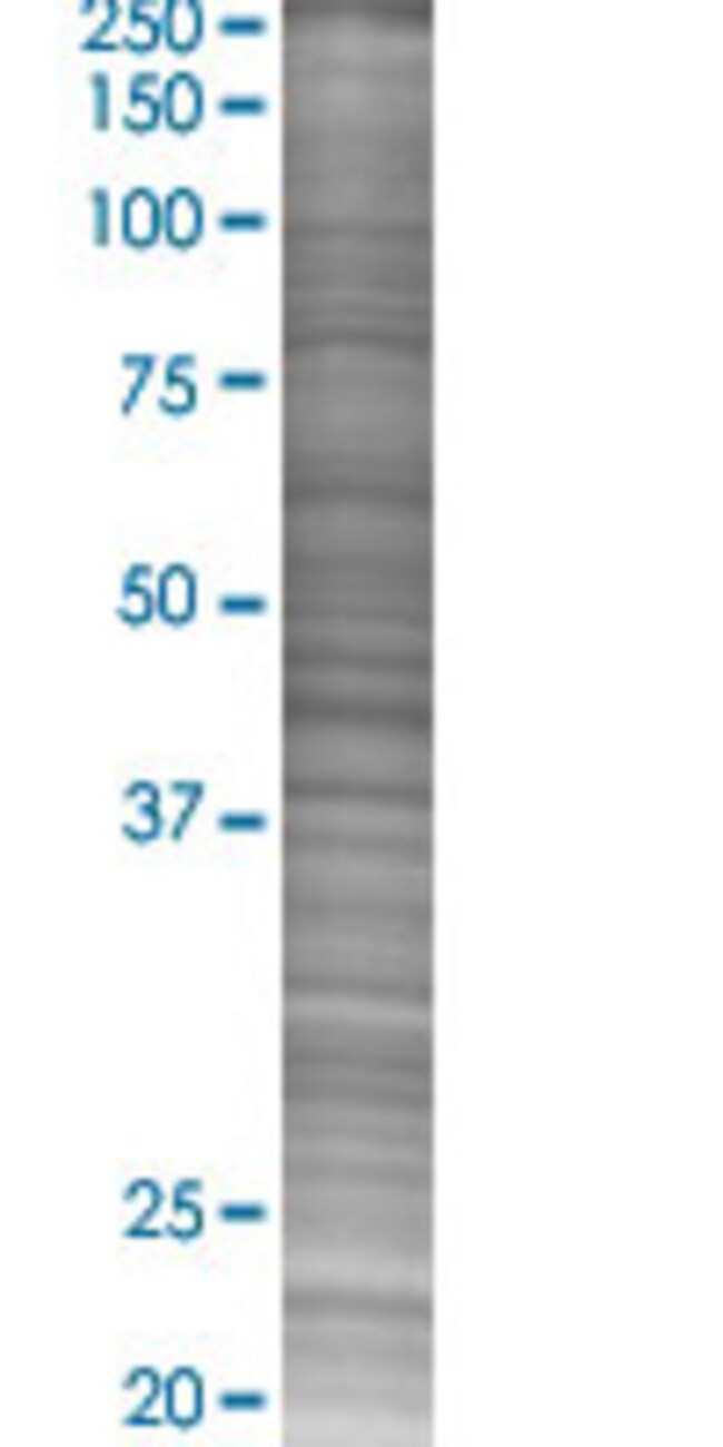 Abnova PCNA 293T Cell Transient Overexpression Lysate (Denatured) 100μL ...