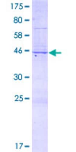 Abnova™ Human VIT Full-length ORF (AAH61519.1, 1 a.a. - 203 a.a.) Recombinant Protein with GST-tag at N-terminal