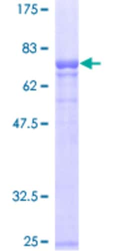Abnova™ Human SERPINA1 Full-length ORF (AAH11991, 1 a.a. - 418 a.a.) Recombinant Protein with GST-tag at N-terminal