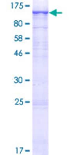 Abnova Human PI4KA Full-length ORF (NP_002641.1, 1 a.a. - 854 a.a.) Recombinant Protein with GST-tag at N-terminal 2 &mu;g | Buy Online | Abnova&trade; | Fisher Scientific