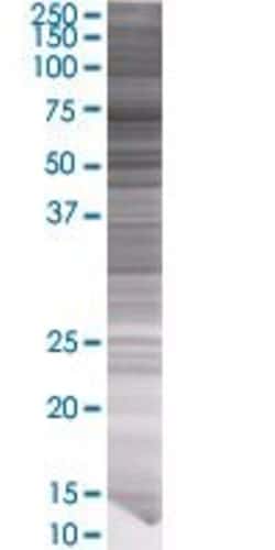 Abnova&trade;&nbsp;PLK1 293T Cell Transient Overexpression Lysate (Denatured) (T01)