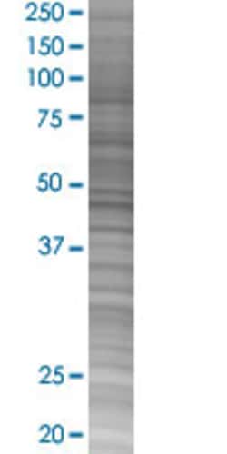 Abnova PLRG1 293T Cell Transient Overexpression Lysate (Denatured) 100 &mu;L | Buy Online | Abnova&trade; | Fisher Scientific