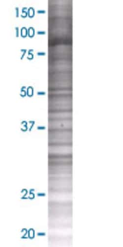 Abnova POU2F1 293T Cell Transient Overexpression Lysate (Denatured) 100 &mu;L | Buy Online | Abnova&trade; | Fisher Scientific
