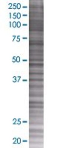 Abnova POU3F4 293T Cell Transient Overexpression Lysate (Denatured) 100 &mu;L | Buy Online | Abnova&trade; | Fisher Scientific