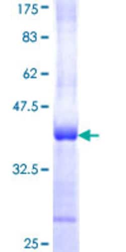 Abnova Human PPP1CA Partial ORF (NP_002699, 224 a.a. - 330 a.a.) Recombinant