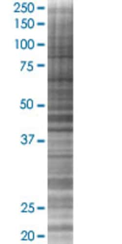 Abnova PPP1CB 293T Cell Transient Overexpression Lysate (Denatured) 100 &mu;L | Buy Online | Abnova&trade; | Fisher Scientific