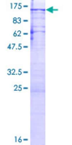 Abnova Human PPP1R10 Full-length ORF (NP_002705.2, 1 a.a. - 940 a.a.) Recombinant Protein with GST-tag at N-terminal 2 &mu;g | Buy Online | Abnova&trade; | Fisher Scientific