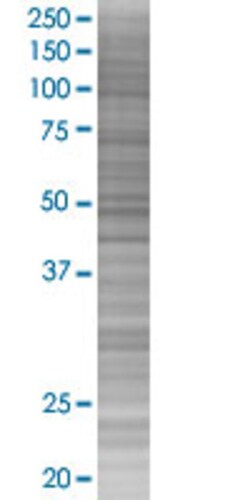 Abnova PPP2R2B 293T Cell Transient Overexpression Lysate (Denatured) 100 &mu;L | Buy Online | Abnova&trade; | Fisher Scientific