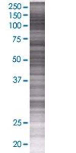 Abnova&trade;&nbsp;PPP2R5A 293T Cell Transient Overexpression Lysate (Denatured)