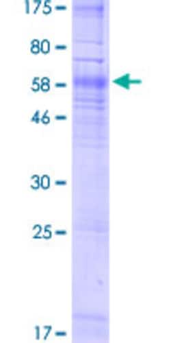 Abnova Human PPYR1 Full-length ORF (AAH99637.1, 1 a.a. - 375 a.a.) Recombinant Protein with GST-tag at N-terminal 10&mu;g | Buy Online | Abnova&trade; | Fisher Scientific