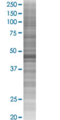 Abnova&trade;&nbsp;PRKAR1A 293T Cell Transient Overexpression Lysate (Denatured)