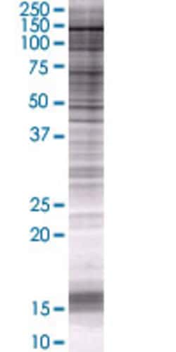 Abnova PSD 293T Cell Transient Overexpression Lysate (Denatured) 100 &mu;L | Buy Online | Abnova&trade; | Fisher Scientific