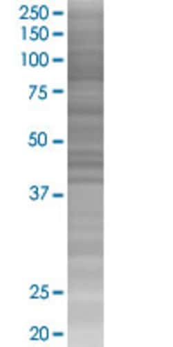 Abnova&trade;&nbsp;PTGER4 293T Cell Transient Overexpression Lysate (Denatured)