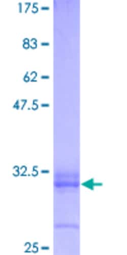 Abnova Human PTPN11 Full-length ORF (AAH25181, 1 a.a. - 50 a.a.) Recombinant Protein with GST-tag at N-terminal 2 &mu;g | Buy Online | Abnova&trade; | Fisher Scientific