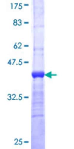 Abnova Human PCYT2 Partial ORF (NP_002852, 25 a.a. - 123 a.a.) Recombinant Protein with GST-tag at N-terminal 25 ug | Buy Online | Abnova&trade; | Fisher Scientific