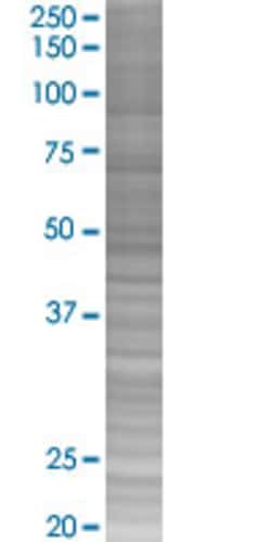 Abnova RAD17 293T Cell Transient Overexpression Lysate (Denatured) (T02) 100 &mu;L | Buy Online | Abnova&trade; | Fisher Scientific