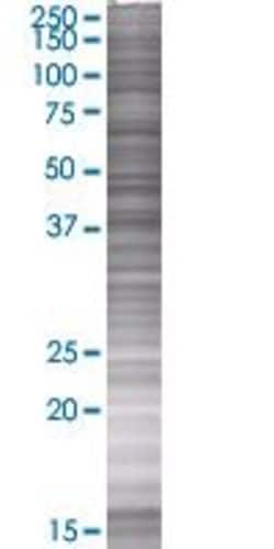 Abnova&trade;&nbsp;RAD51C 293T Cell Transient Overexpression Lysate (Denatured) (T01)