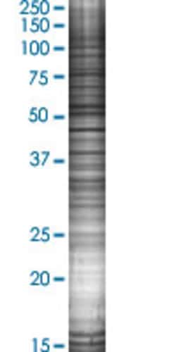 Abnova RAD51C 293T Cell Transient Overexpression Lysate (Denatured) (T02) 100 &mu;L | Buy Online | Abnova&trade; | Fisher Scientific