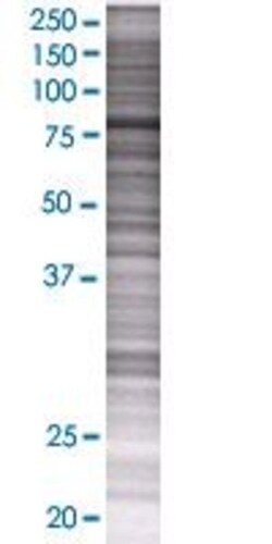 Abnova RNF6 293T Cell Transient Overexpression Lysate (Denatured) 100 &mu;L | Buy Online | Abnova&trade; | Fisher Scientific