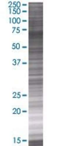 Abnova KNTC2 293T Cell Transient Overexpression Lysate (Denatured) (T01) 100&mu;L | Buy Online | Abnova&trade; | Fisher Scientific