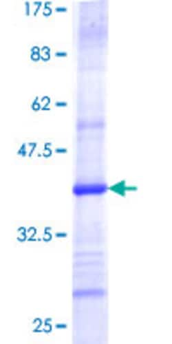Abnova Human TOMM40 Partial ORF (NP_006105, 276 a.a. - 361 a.a.) Recombinant Protein with GST-tag at N-terminal 2 &mu;g | Buy Online | Abnova&trade; | Fisher Scientific