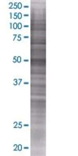 Abnova TIMM44 293T Cell Transient Overexpression Lysate (Denatured) 100 &mu;L | Buy Online | Abnova&trade; | Fisher Scientific