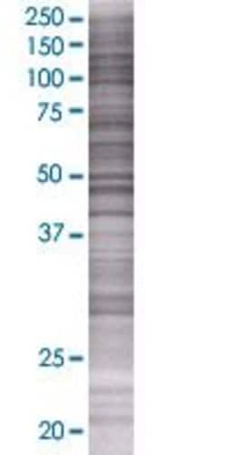 Abnova UBD 293T Cell Transient Overexpression Lysate (Denatured) (T01) 100 &mu;L | Buy Online | Abnova&trade; | Fisher Scientific