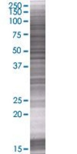 Abnova GAS2L1 293T Cell Transient Overexpression Lysate (Denatured) 100