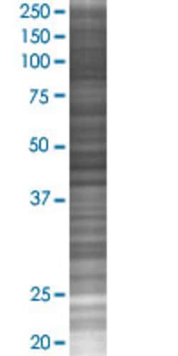 Abnova CUGBP1 293T Cell Transient Overexpression Lysate (Denatured) (T02) 100 &mu;L | Buy Online | Abnova&trade; | Fisher Scientific