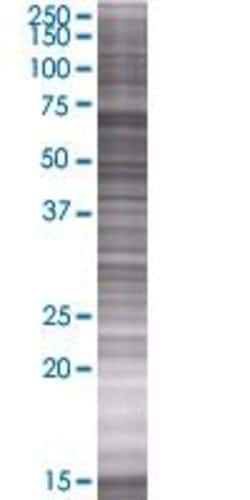 Abnova RAI2 293T Cell Transient Overexpression Lysate (Denatured) 100 &mu;L | Buy Online | Abnova&trade; | Fisher Scientific