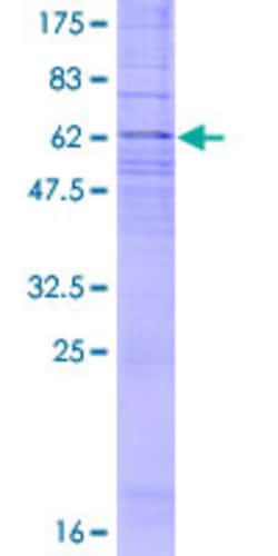 Abnova Human CYSLTR1 Full-length ORF (NP_006630.1, 1 a.a. - 337 a.a.) Recombinant Protein with GST-tag at N-terminal 2 &mu;g | Buy Online | Abnova&trade; | Fisher Scientific
