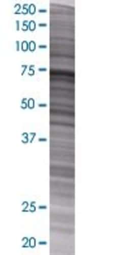 Abnova SEPT9 293T Cell Transient Overexpression Lysate (Denatured) 100 &mu;L | Buy Online | Abnova&trade; | Fisher Scientific