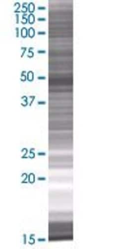 Abnova RUVBL2 293T Cell Transient Overexpression Lysate (Denatured) 100&mu;L | Buy Online | Abnova&trade; | Fisher Scientific