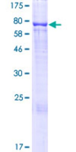 Abnova Human SLC27A2 Full-length ORF (AAH57770.1, 1 a.a. - 567 a.a.) Recombinant Protein with GST-tag at N-terminal 2 &mu;g | Buy Online | Abnova&trade; | Fisher Scientific