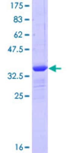 Abnova Human GLIPR1 Partial ORF (NP_006842, 23 a.a. - 99 a.a.) Recombinant Protein with GST-tag at N-terminal 25 &mu;g | Buy Online | Abnova&trade; | Fisher Scientific