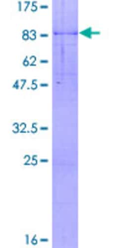 Abnova Human POLS Full-length ORF (NP_008930.1, 1 a.a. - 542 a.a.) Recombinant Protein with GST-tag at N-terminal 2 &mu;g | Buy Online | Abnova&trade; | Fisher Scientific