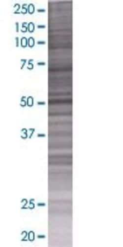 Abnova KRR1 293T Cell Transient Overexpression Lysate (Denatured) (T01) 100&mu;L | Buy Online | Abnova&trade; | Fisher Scientific