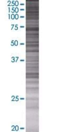 Abnova PWP1 293T Cell Transient Overexpression Lysate (Denatured) (T01) 100 &mu;L | Buy Online | Abnova&trade; | Fisher Scientific
