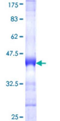 Abnova Human WDHD1 Partial ORF (NP_009017, 1031 a.a. - 1128 a.a.) Recombinant Protein with GST-tag at N-terminal 25 &mu;g | Buy Online | Abnova&trade; | Fisher Scientific