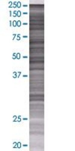 Abnova PTENP1 293T Cell Transient Overexpression Lysate (Denatured) 100 &mu;L | Buy Online | Abnova&trade; | Fisher Scientific
