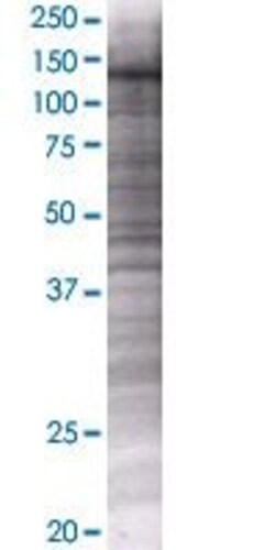Abnova AKAP13 293T Cell Transient Overexpression Lysate (Denatured) (T01) 100 &mu;L | Buy Online | Abnova&trade; | Fisher Scientific