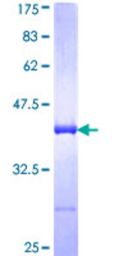 Abnova Human AKAP11 Partial ORF (NP_057332, 1801 a.a. - 1901 a.a.) Recombinant