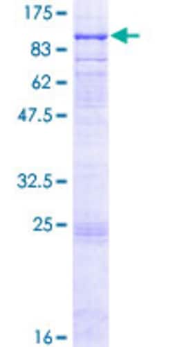 Abnova Human GALNT6 Full-length ORF (NP_009141.2, 1 a.a. - 622 a.a.) Recombinant Protein with GST-tag at N-terminal 2 &mu;g | Buy Online | Abnova&trade; | Fisher Scientific