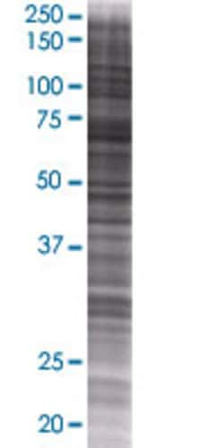 Abnova GALNT6 293T Cell Transient Overexpression Lysate (Denatured) (T01) 100 &mu;L | Buy Online | Abnova&trade; | Fisher Scientific