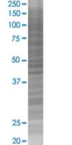 Abnova COG2 293T Cell Transient Overexpression Lysate (Denatured) 100&mu;L | Buy Online | Abnova&trade; | Fisher Scientific