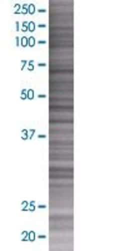 Abnova NLGN4Y 293T Cell Transient Overexpression Lysate (Denatured) (T01) 100 &mu;L | Buy Online | Abnova&trade; | Fisher Scientific