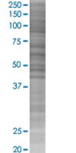 Abnova RHOBTB3 293T Cell Transient Overexpression Lysate (Denatured) (T02) 100 &mu;L | Buy Online | Abnova&trade; | Fisher Scientific